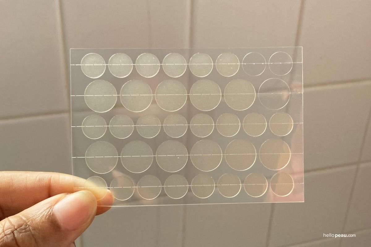 Which Pimple Patch Size Should You Use? The Ultimate Guide