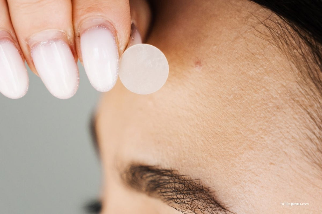 Why Do Pimple Patches Turn White?
