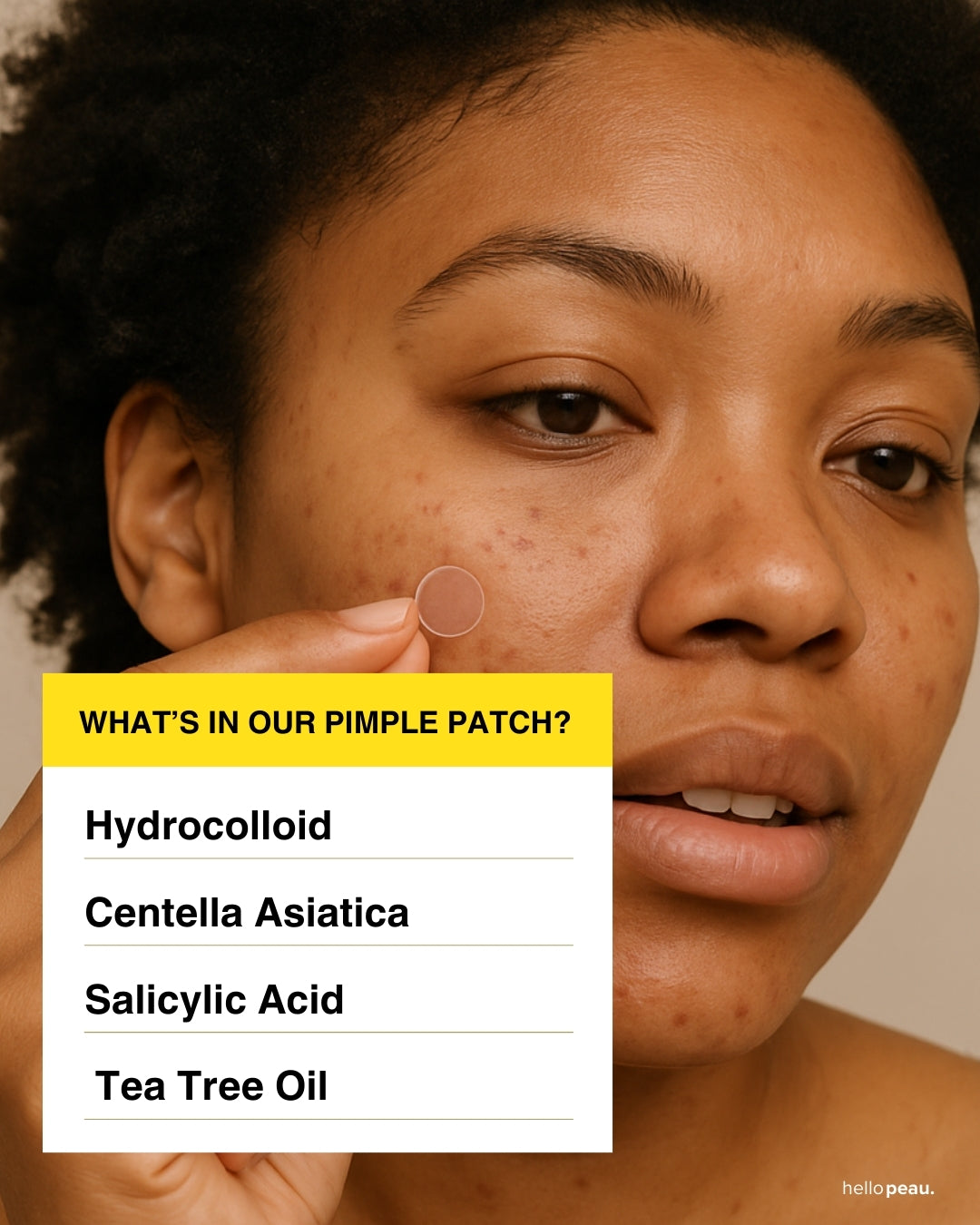 Hello Peau Pimple Stop Hydrocolloid Vegan Invisible Pimple Patches - 72 count