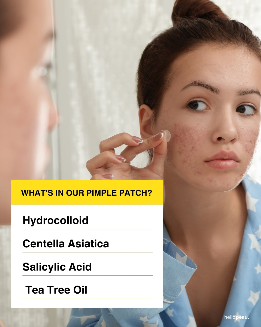 Hello Peau Pimple Stop Hydrocolloid Vegan Invisible Pimple Patches - 36 count